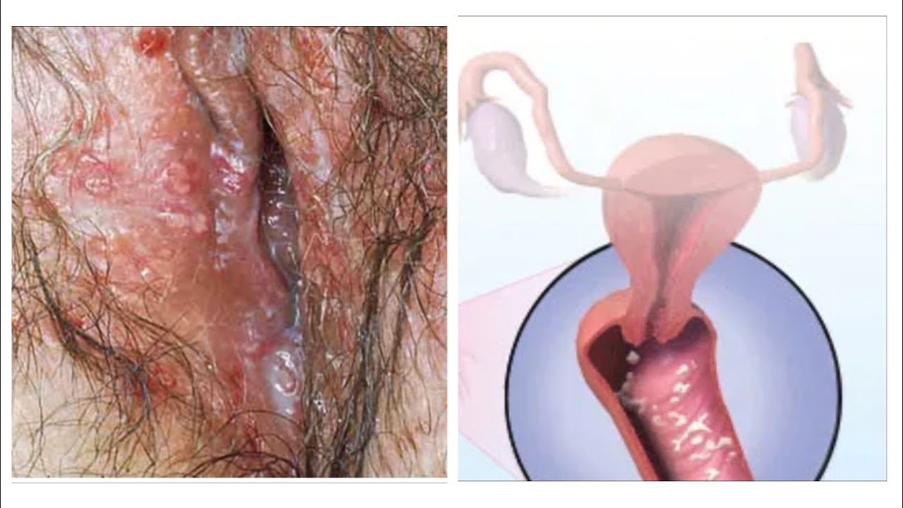 Vaginal odor information